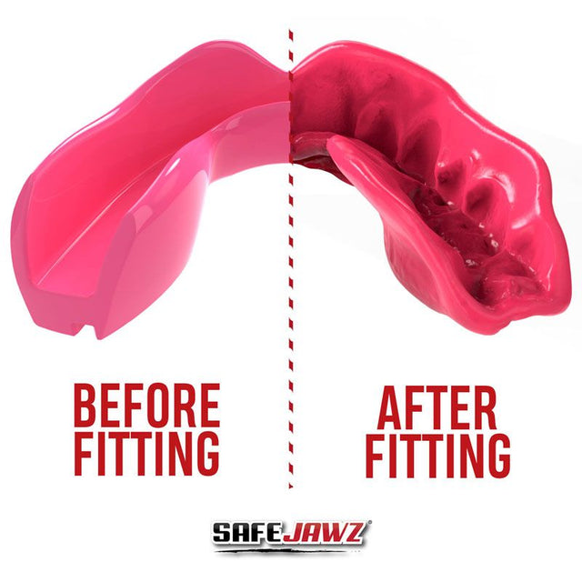 Safejawz Mundschutz Intro Series - Pink - The Fight Company Deutschland