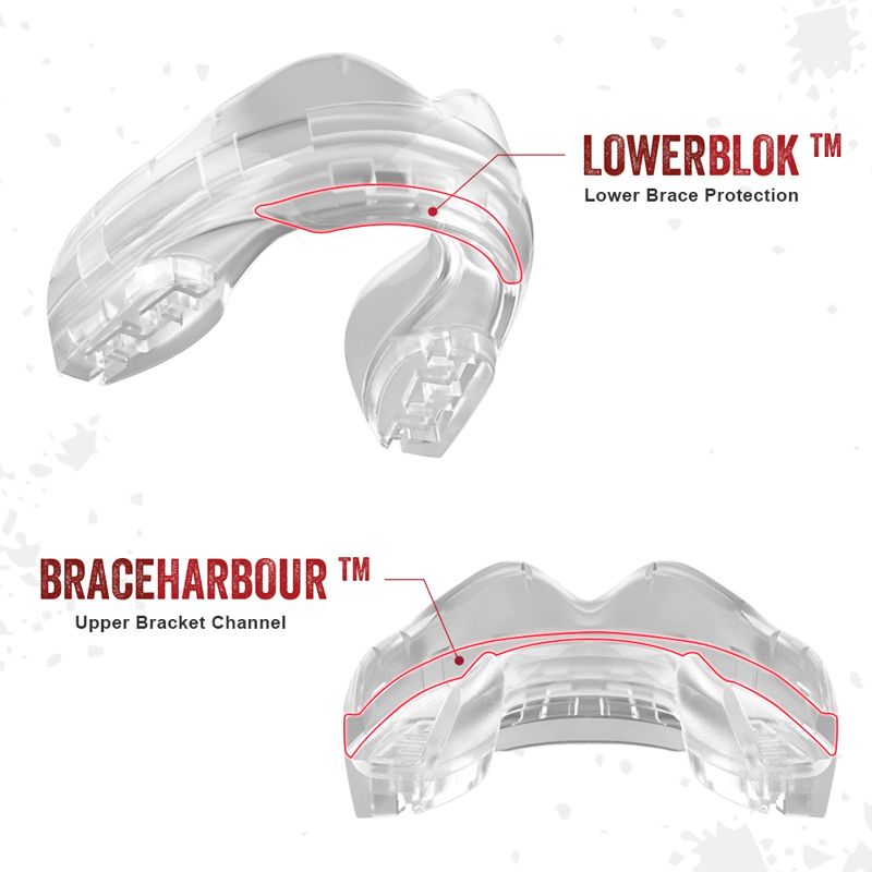 Safejawz Mundschutz für Spange - Transparent - The Fight Company Deutschland
