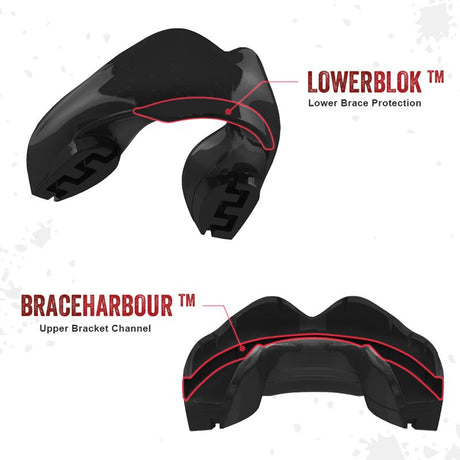 Safejawz Mundschutz für Spange - Schwarz - The Fight Company Deutschland