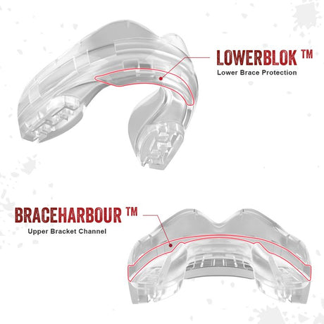 Safejawz Mundschutz für Spange - Transparent - The Fight Company Deutschland